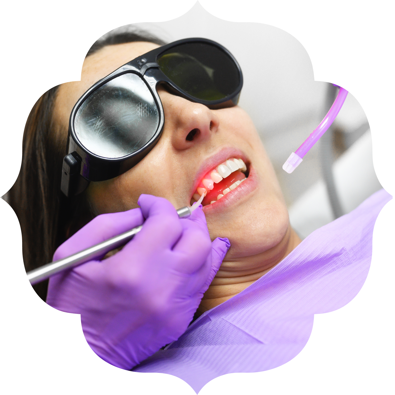 Patiente portant des lunettes de protection pendant un soin au laser