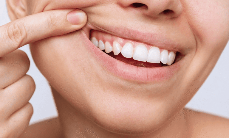 Gros plan sur un sourire, un doigt posé sur la lèvre
